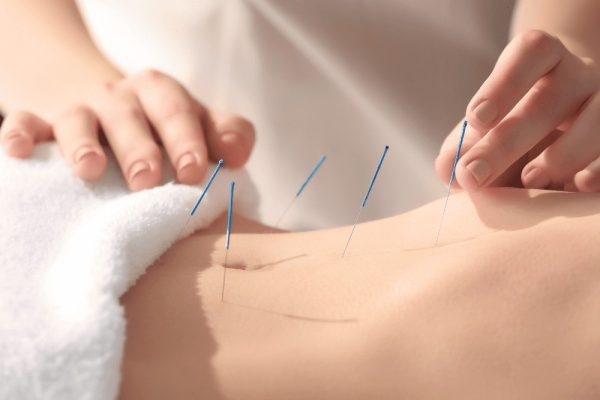 Fertility acupuncture consultation with Tom Kelton at Restore Wellness in Sydney